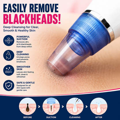 💆‍♀️Pore Cleaning Device | Blackhead Remover Vacuum USB Rechargeable