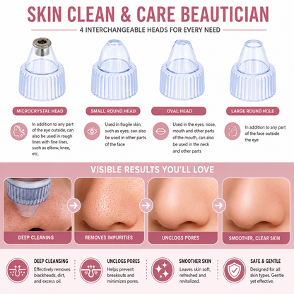 💆‍♀️Pore Cleaning Device | Blackhead Remover Vacuum USB Rechargeable