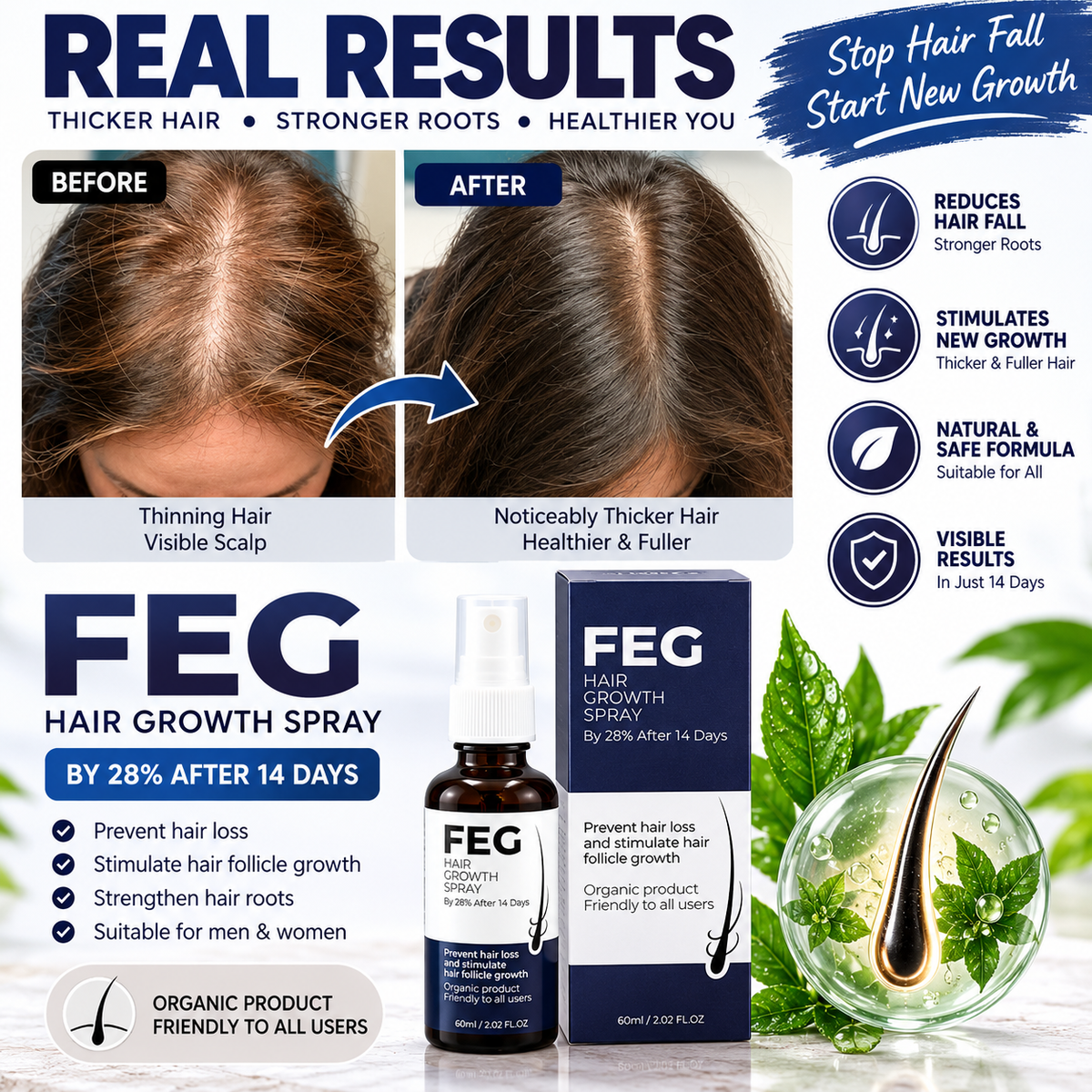 FEG Hair Growth Spray - Stop Hair Fall, Regrow Naturally & Strengthen