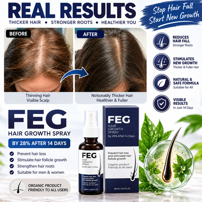 FEG Hair Growth Spray - Stop Hair Fall, Regrow Naturally & Strengthen