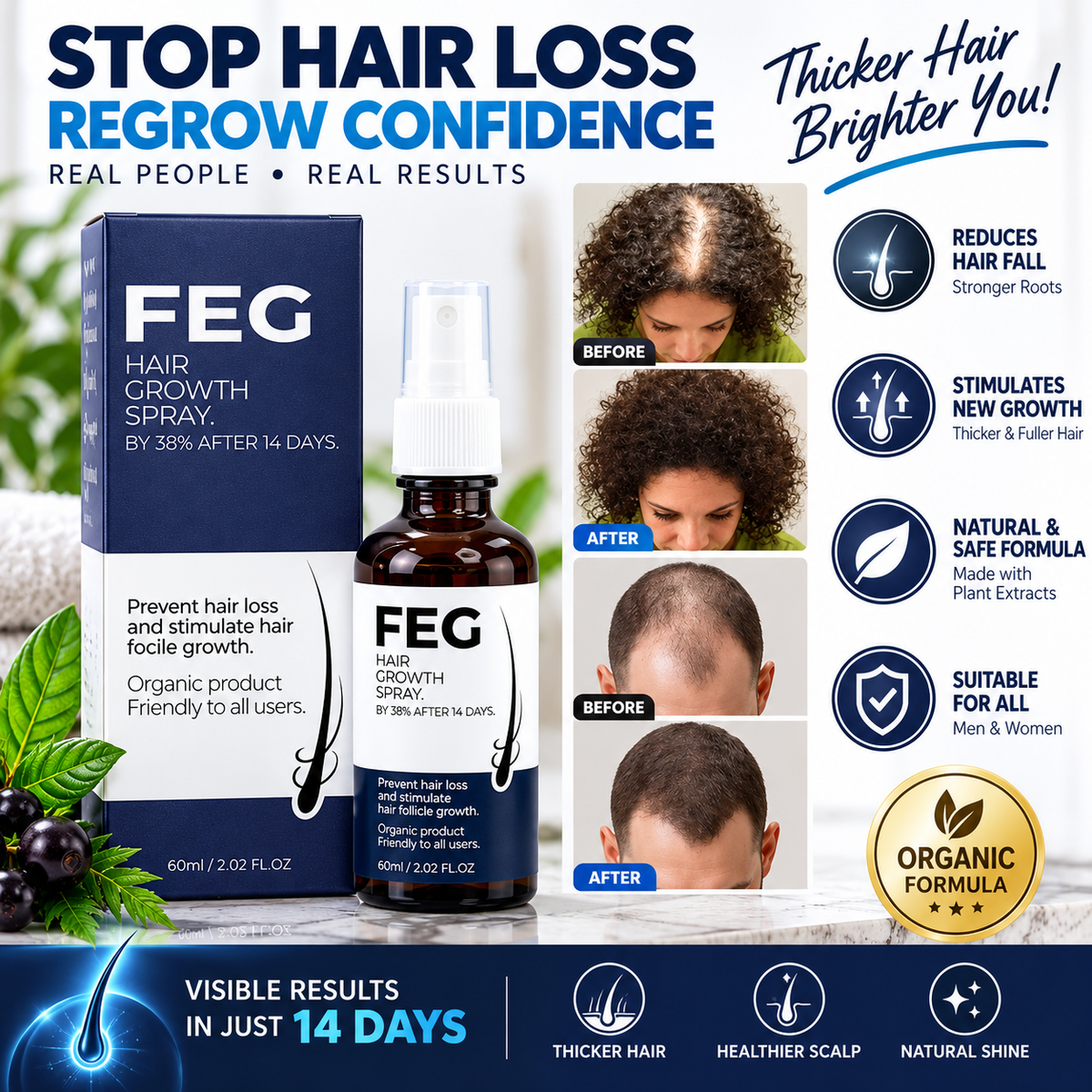 FEG Hair Growth Spray - Stop Hair Fall, Regrow Naturally & Strengthen