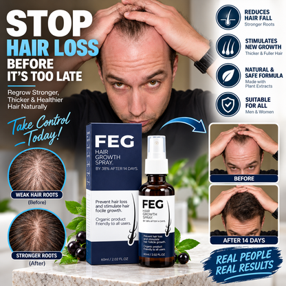 FEG Hair Growth Spray - Stop Hair Fall, Regrow Naturally & Strengthen