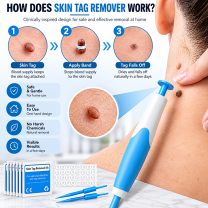 Acrochordon Skin Tag Remover Kit - 2-in-1 Fast & Painless Solution