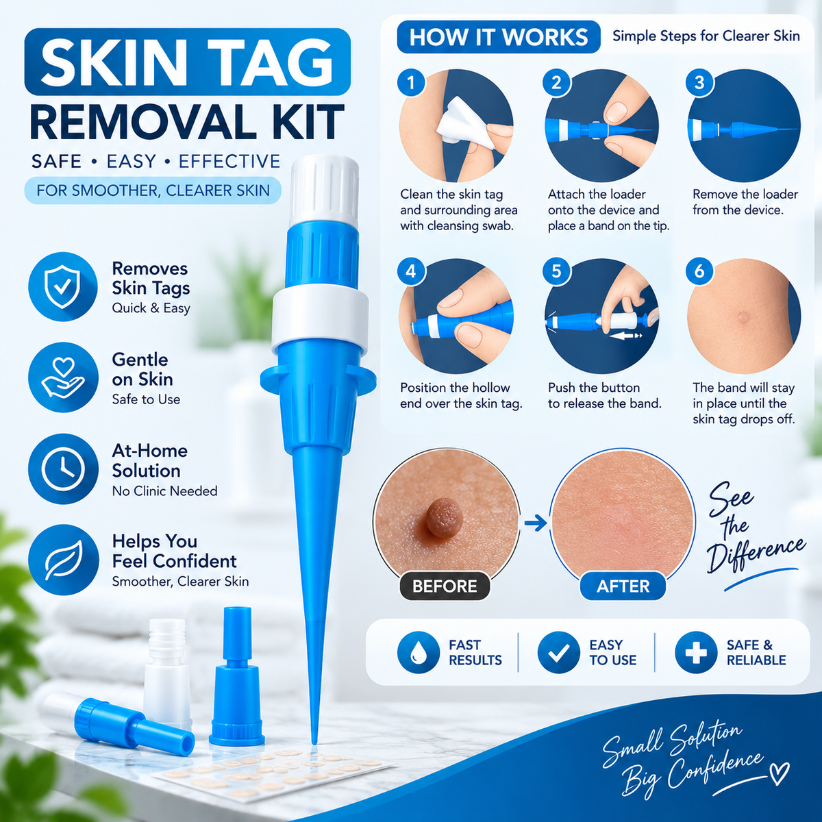 Acrochordon Skin Tag Remover Kit - 2-in-1 Fast & Painless Solution